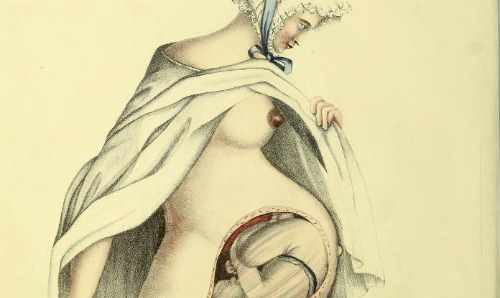 Flap anatomy of a pregnant figure from G. Spratt, Obstetric Tables, 1835